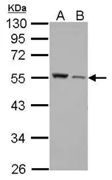 Anti-Desmin antibody used in Western Blot (WB). GTX103557