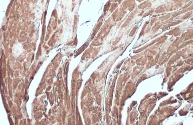 Anti-Desmin antibody used in IHC (Paraffin sections) (IHC-P). GTX103557