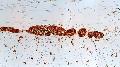 Anti-PGP9.5 antibody [10A1] used in IHC (Paraffin sections) (IHC-P). GTX10358