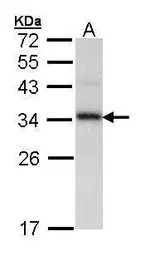 Anti-Cyclophilin E antibody used in Western Blot (WB). GTX103662