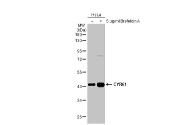 Anti-CYR61 antibody [N1C3] used in Western Blot (WB). GTX103669