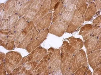 Anti-HSF2BP antibody used in IHC (Paraffin sections) (IHC-P). GTX103673