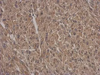 Anti-HSF2BP antibody used in IHC (Paraffin sections) (IHC-P). GTX103673