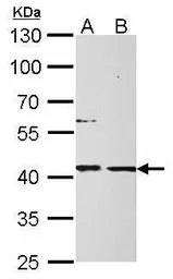 Anti-MPI antibody used in Western Blot (WB). GTX103682