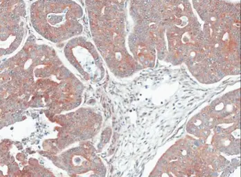 Anti-MPI antibody used in IHC (Paraffin sections) (IHC-P). GTX103682