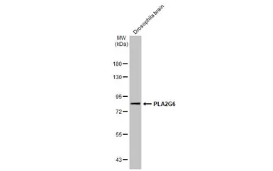 Anti-PLA2G6 antibody [N3C3] used in Western Blot (WB). GTX103717