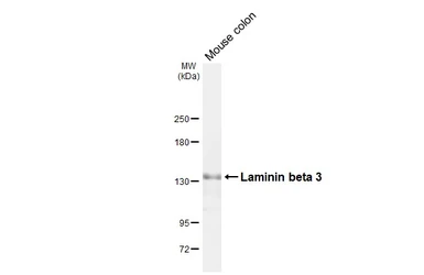 Anti-Laminin beta 3 antibody [C1C2], Internal used in Western Blot (WB). GTX103736
