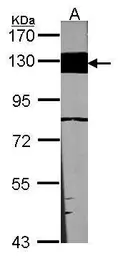 Anti-Laminin beta 3 antibody [C1C2], Internal used in Western Blot (WB). GTX103736