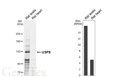 Anti-USP8 antibody used in Western Blot (WB). GTX103747