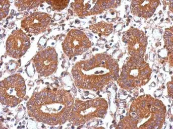 Anti-USP8 antibody used in IHC (Paraffin sections) (IHC-P). GTX103747