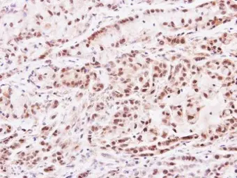 Anti-PRMT2 antibody [N1C2] used in IHC (Paraffin sections) (IHC-P). GTX103749