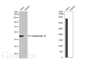 Anti-Cytokeratin 17 antibody used in Western Blot (WB). GTX103765