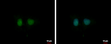 Anti-DDI1 antibody [N1C3] used in Immunocytochemistry/ Immunofluorescence (ICC/IF). GTX103772