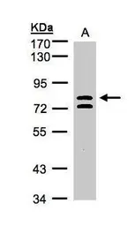 Anti-L3MBTL1 antibody used in Western Blot (WB). GTX103793