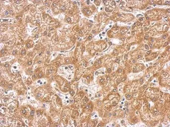 Anti-PAK1 antibody used in IHC (Paraffin sections) (IHC-P). GTX103797