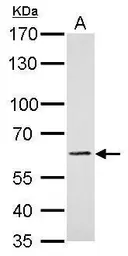 Anti-PAK1 antibody used in Western Blot (WB). GTX103797