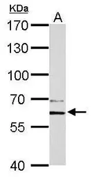 Anti-PAK1 antibody used in Western Blot (WB). GTX103797