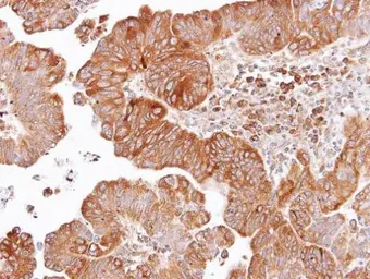 Anti-Dishevelled 2 antibody [N2C2], Internal used in IHC (Paraffin sections) (IHC-P). GTX103878