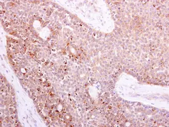 Anti-NOX1 antibody used in IHC (Paraffin sections) (IHC-P). GTX103888