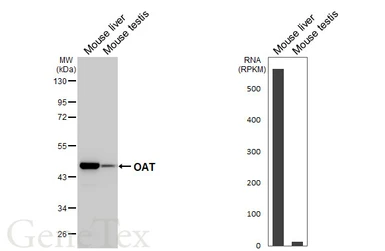 Anti-OAT antibody [N1C3] used in Western Blot (WB). GTX103893