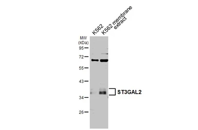 Anti-ST3GAL2 antibody [N2C3] used in Western Blot (WB). GTX103942