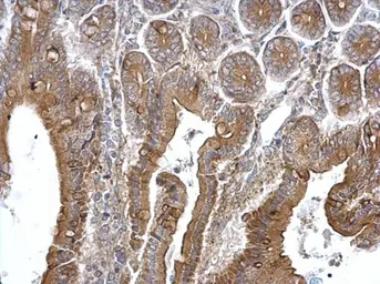 Anti-TPK1 antibody used in IHC (Paraffin sections) (IHC-P). GTX103943