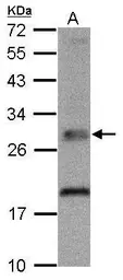 Anti-TPK1 antibody used in Western Blot (WB). GTX103943
