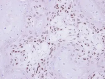 Anti-IP6K1 antibody used in IHC (Paraffin sections) (IHC-P). GTX103949