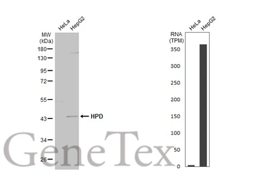Anti-HPD antibody [N1C2] used in Western Blot (WB). GTX103994