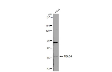 Anti-TEAD4 antibody used in Western Blot (WB). GTX104026