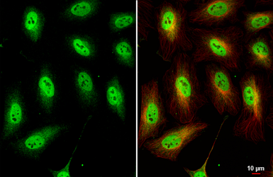 Anti-TEAD4 antibody used in Immunocytochemistry/ Immunofluorescence (ICC/IF). GTX104026