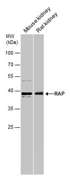 Anti-LRPAP1 antibody [N1C3] used in Western Blot (WB). GTX104033
