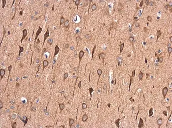Anti-LRPAP1 antibody [N1C3] used in IHC (Paraffin sections) (IHC-P). GTX104033