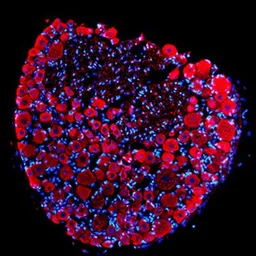 Anti-PGP9.5 antibody used in Immunohistochemistry (IHC). GTX10404