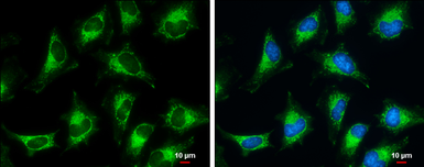 Anti-Pyruvate Dehydrogenase E1 beta subunit antibody used in Immunocytochemistry/ Immunofluorescence (ICC/IF). GTX104040