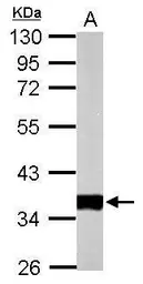 Anti-Pyruvate Dehydrogenase E1 beta subunit antibody used in Western Blot (WB). GTX104040