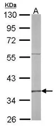 Anti-RFC4 antibody [N1C3] used in Western Blot (WB). GTX104052