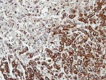 Anti-FPGT antibody [N2C2], Internal used in IHC (Paraffin sections) (IHC-P). GTX104056