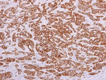 Anti-PON2 antibody [N1C2] used in IHC (Paraffin sections) (IHC-P). GTX104061