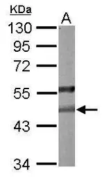 Anti-PON2 antibody [N1C2] used in Western Blot (WB). GTX104061
