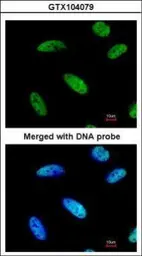 Anti-DNAJC7 antibody [N2C3] used in Immunocytochemistry/ Immunofluorescence (ICC/IF). GTX104079
