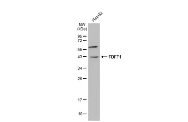 Anti-FDFT1 antibody [N2C3] used in Western Blot (WB). GTX104091