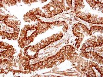 Anti-ME1 antibody used in IHC (Paraffin sections) (IHC-P). GTX104122