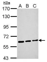 Anti-ME1 antibody used in Western Blot (WB). GTX104122