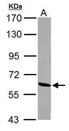 Anti-ME1 antibody used in Western Blot (WB). GTX104122