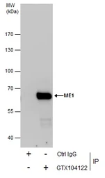 Anti-ME1 antibody used in Immunoprecipitation (IP). GTX104122