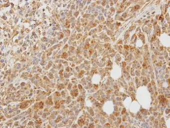 Anti-PCOLCE antibody [N1C3] used in IHC (Paraffin sections) (IHC-P). GTX104154