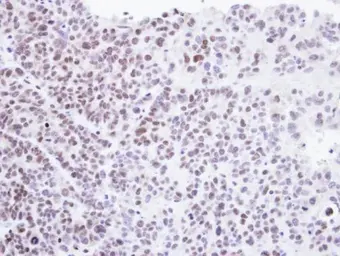 Anti-HMBOX1 antibody [N3C3] used in IHC (Paraffin sections) (IHC-P). GTX104189