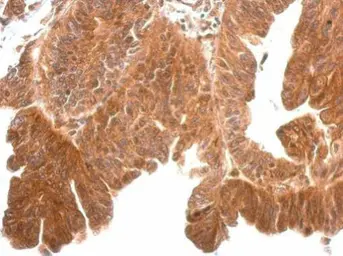 Anti-Kallikrein 11 antibody [N1C3] used in IHC (Paraffin sections) (IHC-P). GTX104200