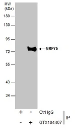 Anti-Grp75 antibody used in Immunoprecipitation (IP). GTX104407